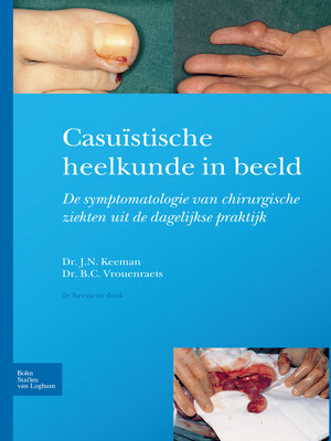 cover image of Casuïstische heelkunde in beeld